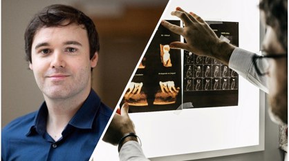 AI is gaining ground in dentistry: “Responsible for evaluating and validating to ensure reliability”